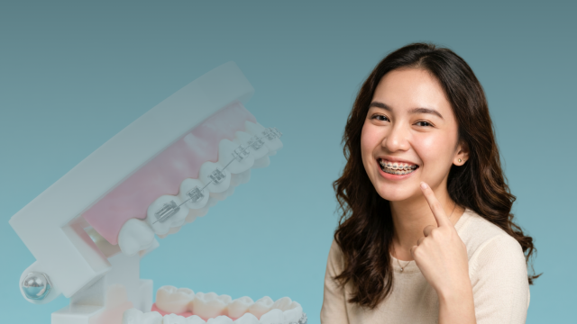 4 Alasan Mengapa Behel Tidak Hanya Membuat Gigi Rapi, Tetapi Juga Menjaga Kesehatan Gigi