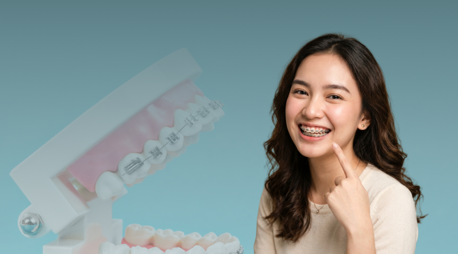 4 Alasan Mengapa Behel Tidak Hanya Membuat Gigi Rapi, Tetapi Juga Menjaga Kesehatan Gigi