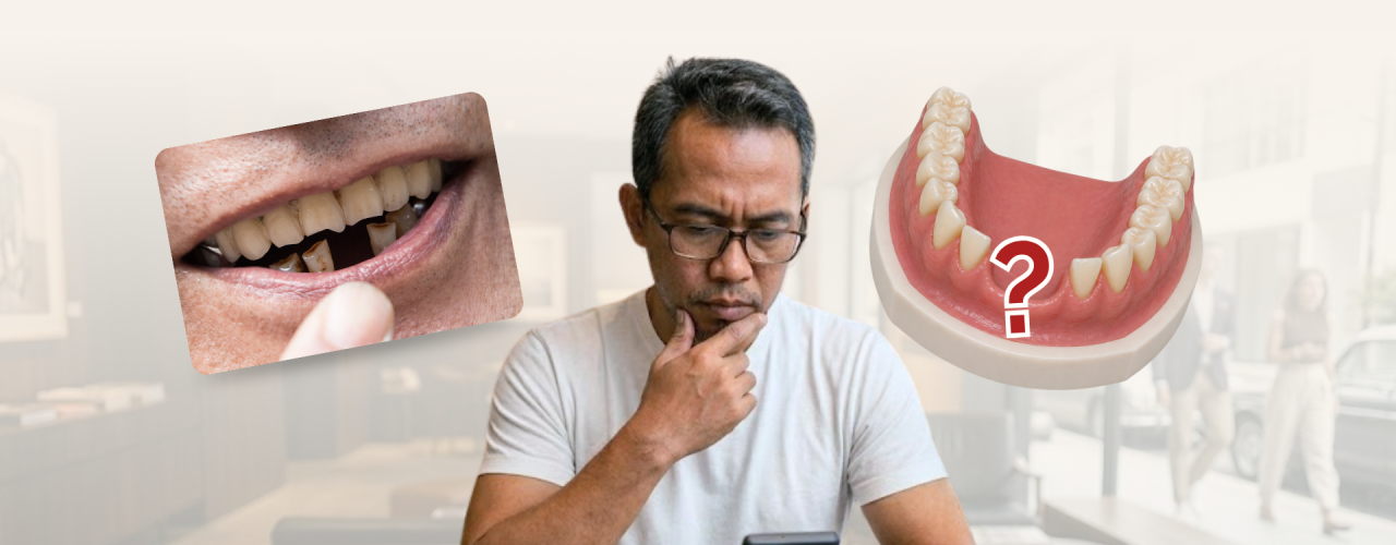 Kamu Lagi Bingung Memilih Gigi Palsu?