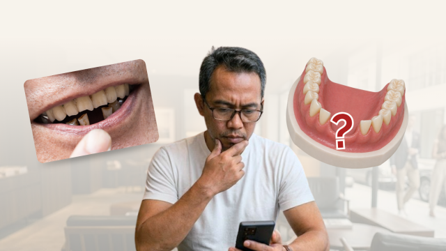 Kamu Lagi Bingung Memilih Gigi Palsu?