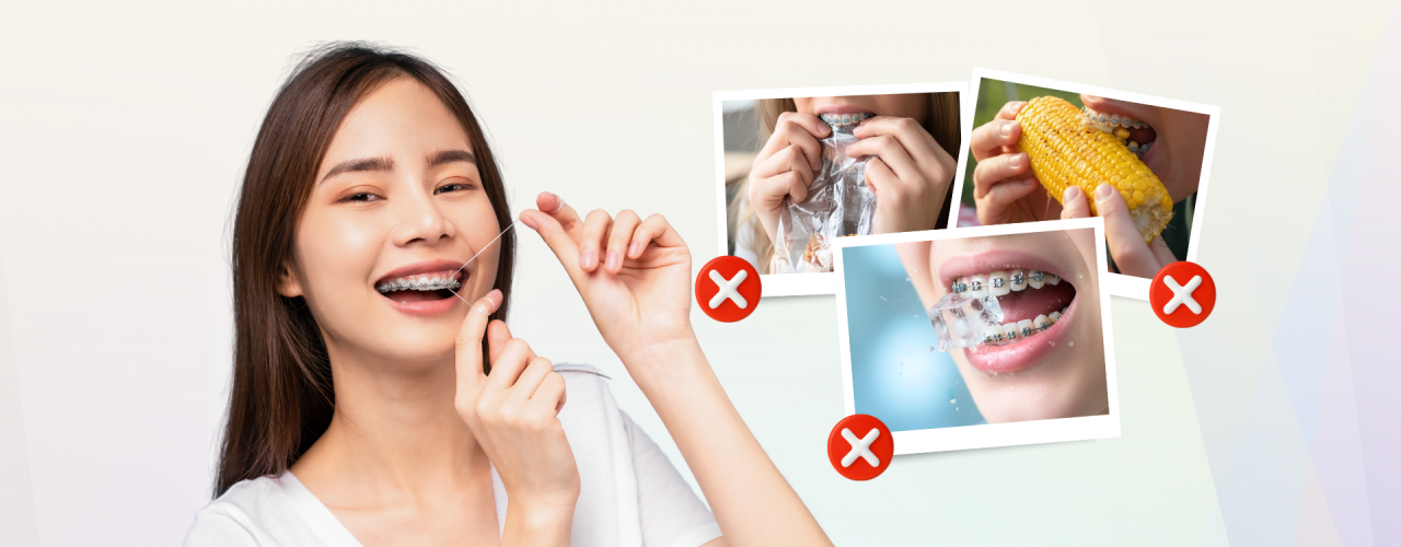 Tips Bracket Anti Copot