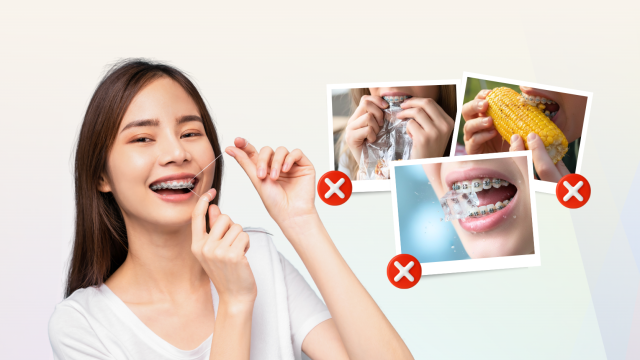 Tips Bracket Anti Copot