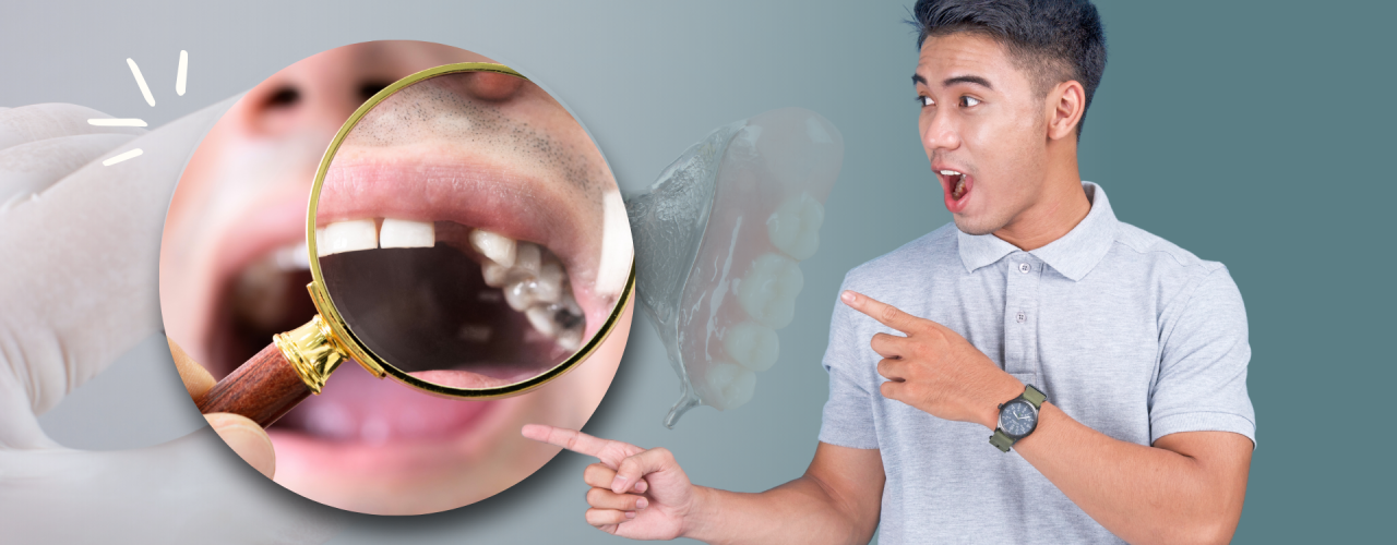 Jangan Sampai Gigi Ompong Mengganggu Kesehatan dan Kepercayaan Diri