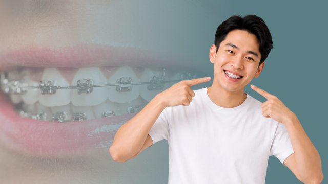 Mengenal Behel Self-Ligating: Perawatan Ortodonti Tanpa Karet Elastis