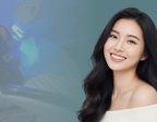 Bleaching vs Veneer: Mana yang Tepat untuk Membuat Gigi Lebih Putih?