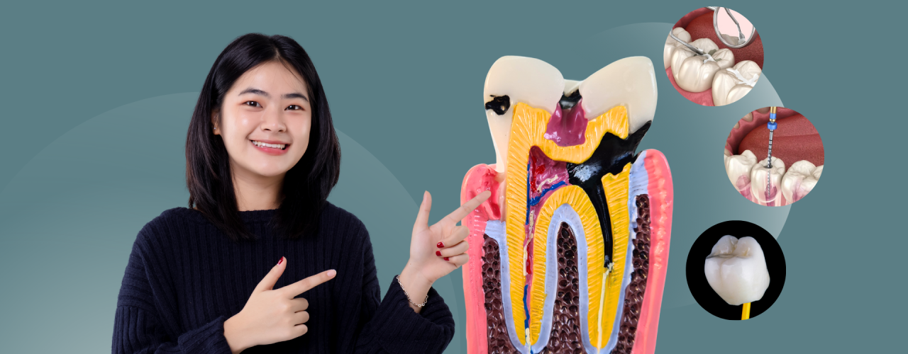 Tidak Semua Gigi Berlubang Harus Dicabut