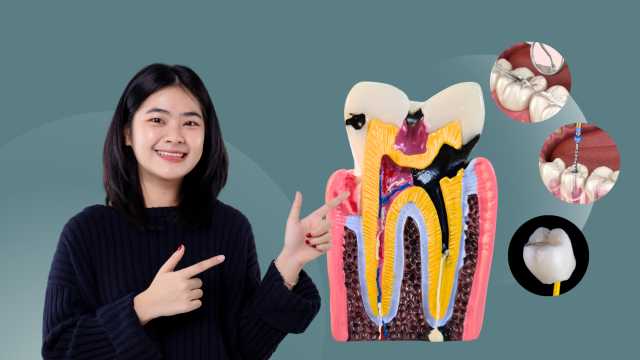 Tidak Semua Gigi Berlubang Harus Dicabut