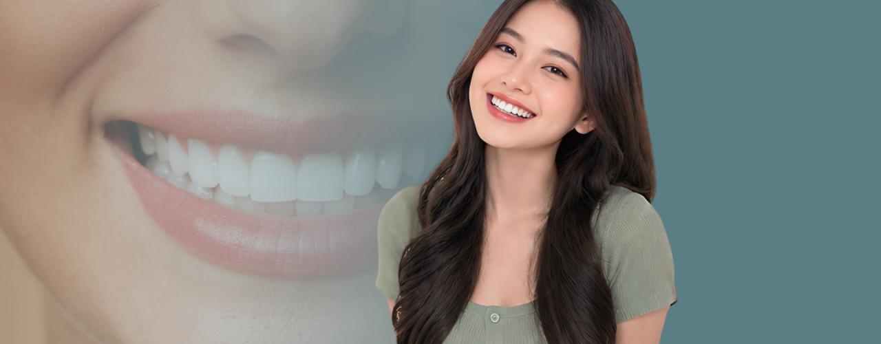 Dental Veneers: Solusi untuk Senyum Lebih Rapi, Cerah, dan Natural