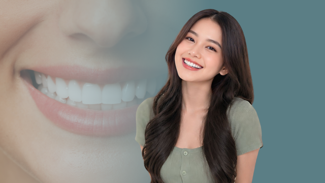 Dental Veneers: Solusi untuk Senyum Lebih Rapi, Cerah, dan Natural