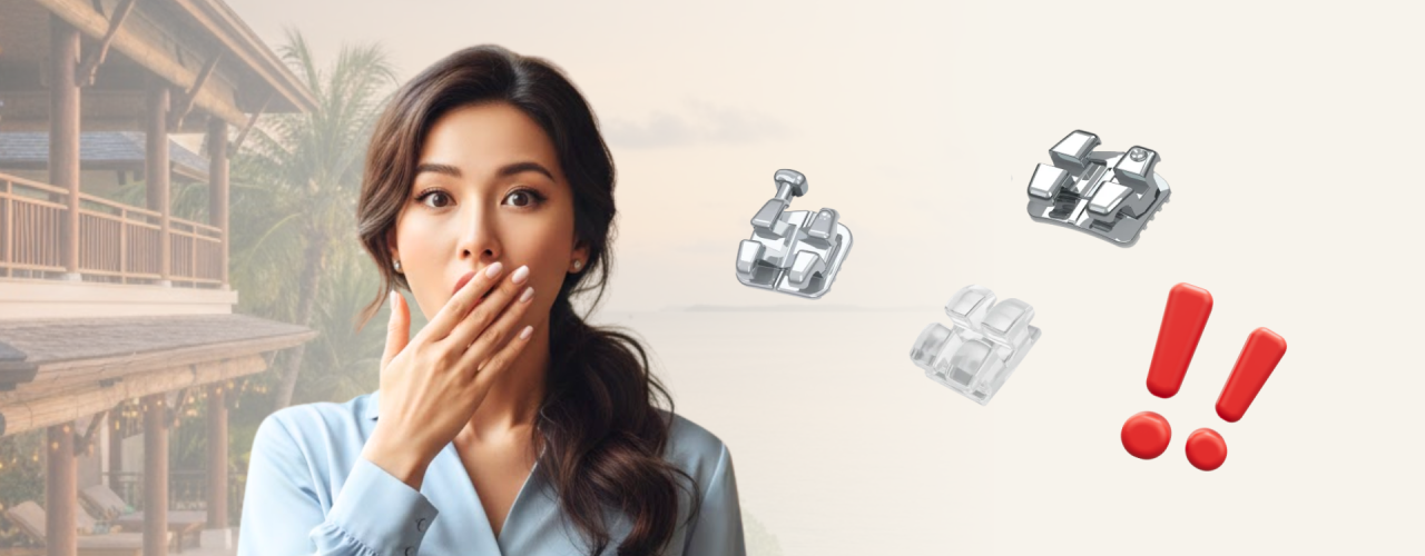 Sedang Liburan & Bracket Lepas?